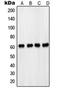 3-Phosphoinositide Dependent Protein Kinase 1 antibody, orb214377, Biorbyt, Western Blot image 