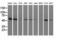 Syntrophin Alpha 1 antibody, GTX83606, GeneTex, Western Blot image 