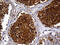 A-Kinase Anchoring Protein 12 antibody, M02303, Boster Biological Technology, Immunohistochemistry paraffin image 