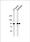 Heat shock protein HSP 90-alpha 1 antibody, PA5-49672, Invitrogen Antibodies, Western Blot image 