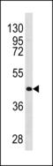 HAP antibody, LS-C203837, Lifespan Biosciences, Western Blot image 