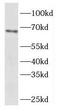 Eyes absent homolog 4 antibody, FNab02916, FineTest, Western Blot image 