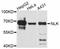 Nemo Like Kinase antibody, abx125032, Abbexa, Western Blot image 