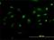 NIMA Related Kinase 2 antibody, H00004751-M02, Novus Biologicals, Immunofluorescence image 