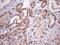 Mediator Complex Subunit 15 antibody, TA807906S, Origene, Immunohistochemistry paraffin image 