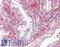 Vascular Endothelial Growth Factor C antibody, LS-B10683, Lifespan Biosciences, Immunohistochemistry frozen image 