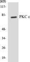 Protein Kinase C Epsilon antibody, EKC1465, Boster Biological Technology, Western Blot image 