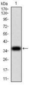 Uncoupling Protein 2 antibody, NBP2-52581, Novus Biologicals, Western Blot image 