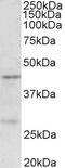Ubinuclein-1 antibody, 43-065, ProSci, Western Blot image 