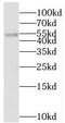 Serine/Threonine Kinase 24 antibody, FNab08327, FineTest, Western Blot image 