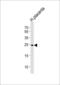 Acidic Nuclear Phosphoprotein 32 Family Member B antibody, LS-C156366, Lifespan Biosciences, Western Blot image 
