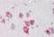 Progressive ankylosis protein antibody, orb314118, Biorbyt, Immunohistochemistry paraffin image 