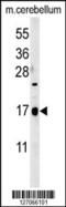Stum, Mechanosensory Transduction Mediator Homolog antibody, 61-959, ProSci, Western Blot image 