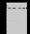 Nuclear pore glycoprotein p62 antibody, 204042-T46, Sino Biological, Western Blot image 