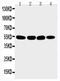 Matrilin 3 antibody, PA5-79635, Invitrogen Antibodies, Western Blot image 