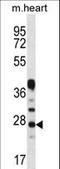 Beta-crystallin A1 antibody, LS-C167065, Lifespan Biosciences, Western Blot image 