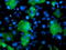 LIM domain kinase 1 antibody, LS-C173082, Lifespan Biosciences, Immunofluorescence image 
