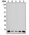 Ribosomal Protein L36 antibody, LS-C353377, Lifespan Biosciences, Western Blot image 