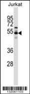 Vacuolar protein sorting-associated protein 4B antibody, 57-287, ProSci, Western Blot image 