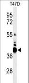V-Set Domain Containing T Cell Activation Inhibitor 1 antibody, LS-C160555, Lifespan Biosciences, Western Blot image 