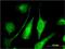 Adenylate Kinase 9 antibody, H00221264-M01, Novus Biologicals, Immunocytochemistry image 