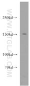 ERCC Excision Repair 6, Chromatin Remodeling Factor antibody, 20548-1-AP, Proteintech Group, Western Blot image 