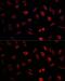 NEDD1 Gamma-Tubulin Ring Complex Targeting Factor antibody, GTX32744, GeneTex, Immunocytochemistry image 