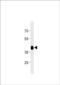 Homeobox protein Hox-C11a antibody, PA5-72618, Invitrogen Antibodies, Western Blot image 