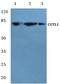 CASP antibody, PA5-36355, Invitrogen Antibodies, Western Blot image 