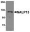 NLR Family Pyrin Domain Containing 13 antibody, A17156, Boster Biological Technology, Western Blot image 