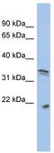 Cyclin-dependent kinase 1 antibody, TA330322, Origene, Western Blot image 