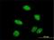 Protein Inhibitor Of Activated STAT 2 antibody, H00009063-M01, Novus Biologicals, Immunofluorescence image 
