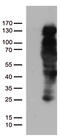 Progesterone Receptor antibody, TA805565S, Origene, Western Blot image 