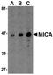 MHC Class I Polypeptide-Related Sequence A antibody, NBP1-76805, Novus Biologicals, Western Blot image 