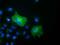 SH3 Domain Containing GRB2 Like 1, Endophilin A2 antibody, GTX83658, GeneTex, Immunocytochemistry image 