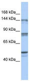 Chromosome Segregation 1 Like antibody, TA330317, Origene, Western Blot image 