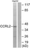 C-C Motif Chemokine Receptor Like 2 antibody, GTX87075, GeneTex, Western Blot image 