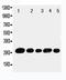 Uncoupling Protein 1 antibody, PA1982, Boster Biological Technology, Western Blot image 