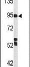 Complement C7 antibody, PA5-26270, Invitrogen Antibodies, Western Blot image 