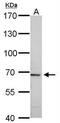 Plasminogen Activator, Tissue Type antibody, NBP2-20648, Novus Biologicals, Western Blot image 