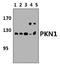 PRK1 antibody, PA5-75550, Invitrogen Antibodies, Western Blot image 