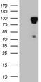 Eukaryotic Translation Elongation Factor 1 Delta antibody, CF811678, Origene, Western Blot image 