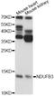 NADH:Ubiquinone Oxidoreductase Subunit B3 antibody, A12461, Boster Biological Technology, Western Blot image 