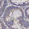 Natriuretic Peptide A antibody, A1609, ABclonal Technology, Immunohistochemistry paraffin image 