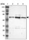 UPF3B Regulator Of Nonsense Mediated MRNA Decay antibody, NBP1-83135, Novus Biologicals, Western Blot image 