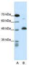 COP9 Signalosome Subunit 2 antibody, TA335758, Origene, Western Blot image 