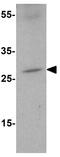 Zinc Finger BED-Type Containing 3 antibody, GTX85290, GeneTex, Western Blot image 