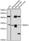 Single-strand selective monofunctional uracil DNA glycosylase antibody, GTX64640, GeneTex, Western Blot image 