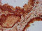 Elongator Acetyltransferase Complex Subunit 4 antibody, LS-C680420, Lifespan Biosciences, Immunohistochemistry paraffin image 
