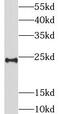 Lin-7 Homolog B, Crumbs Cell Polarity Complex Component antibody, FNab04789, FineTest, Western Blot image 